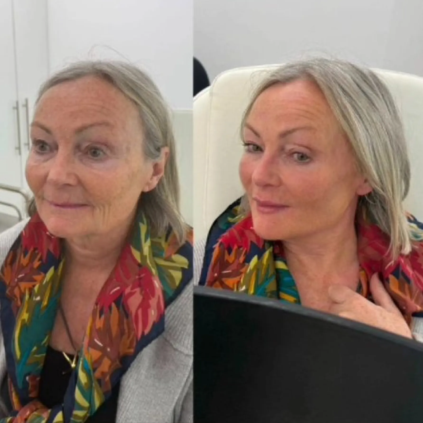 Imagem comparativa de antes e depois 1, em validação