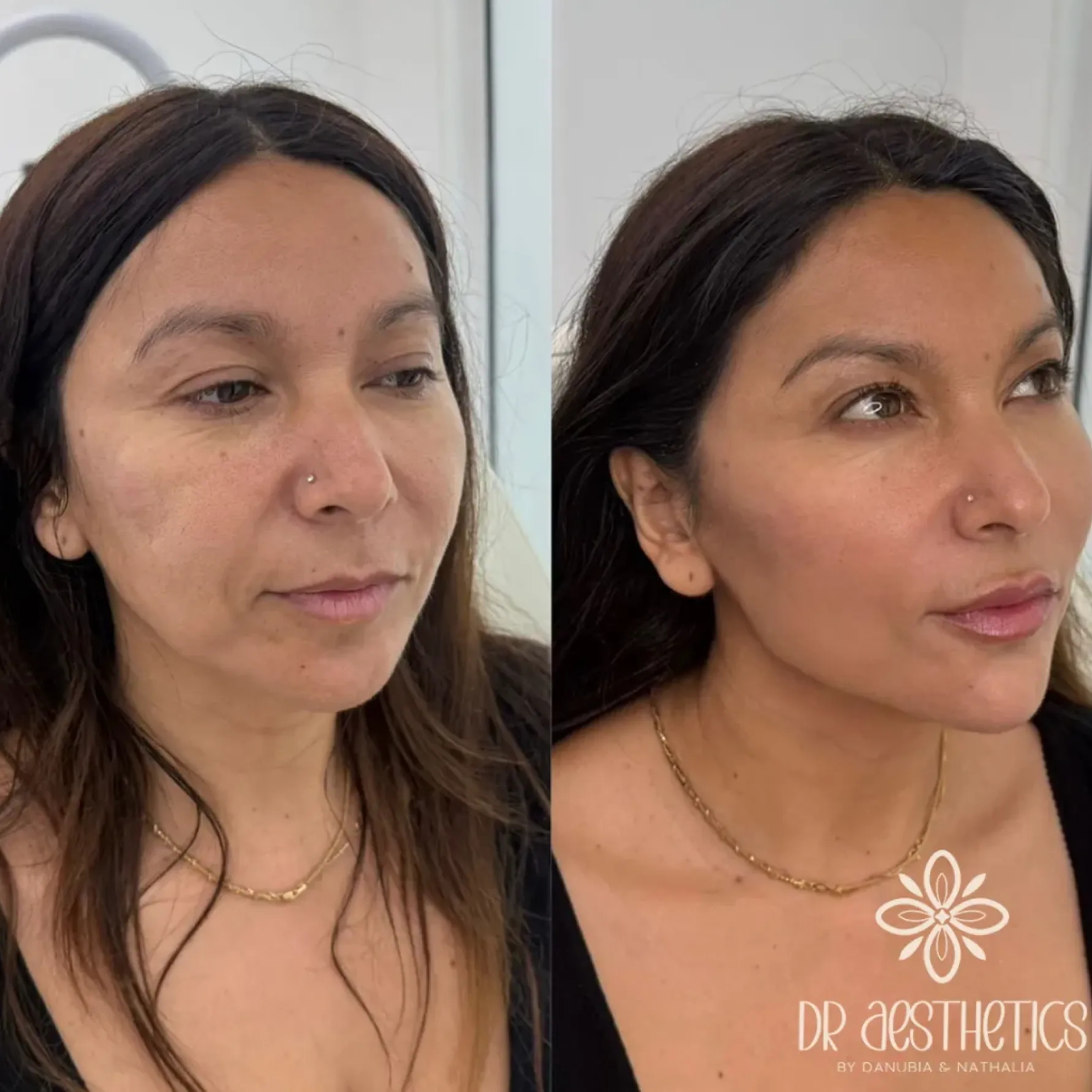 Imagem comparativa de antes e depois 2, em validação