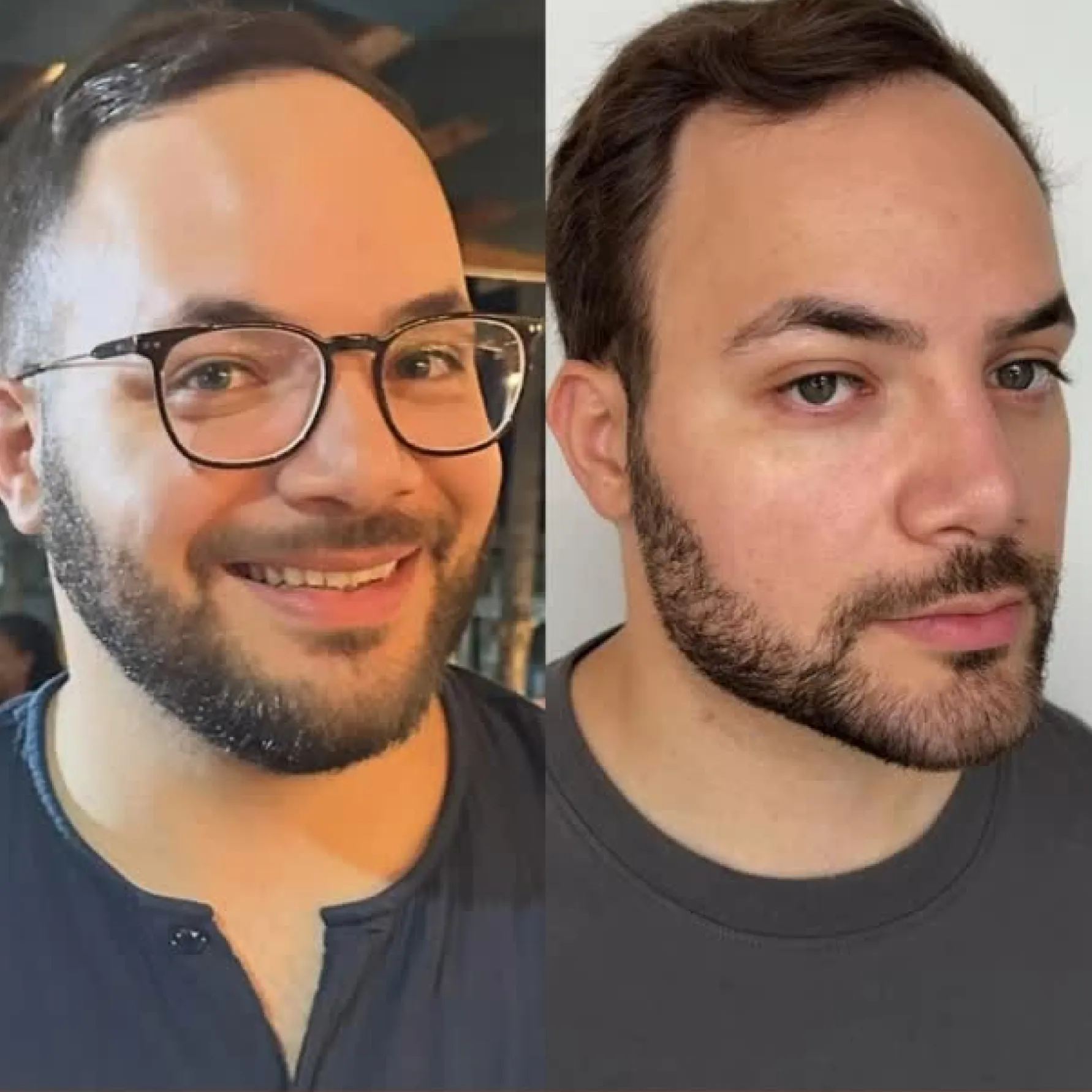Imagem comparativa de antes e depois 3, em validação