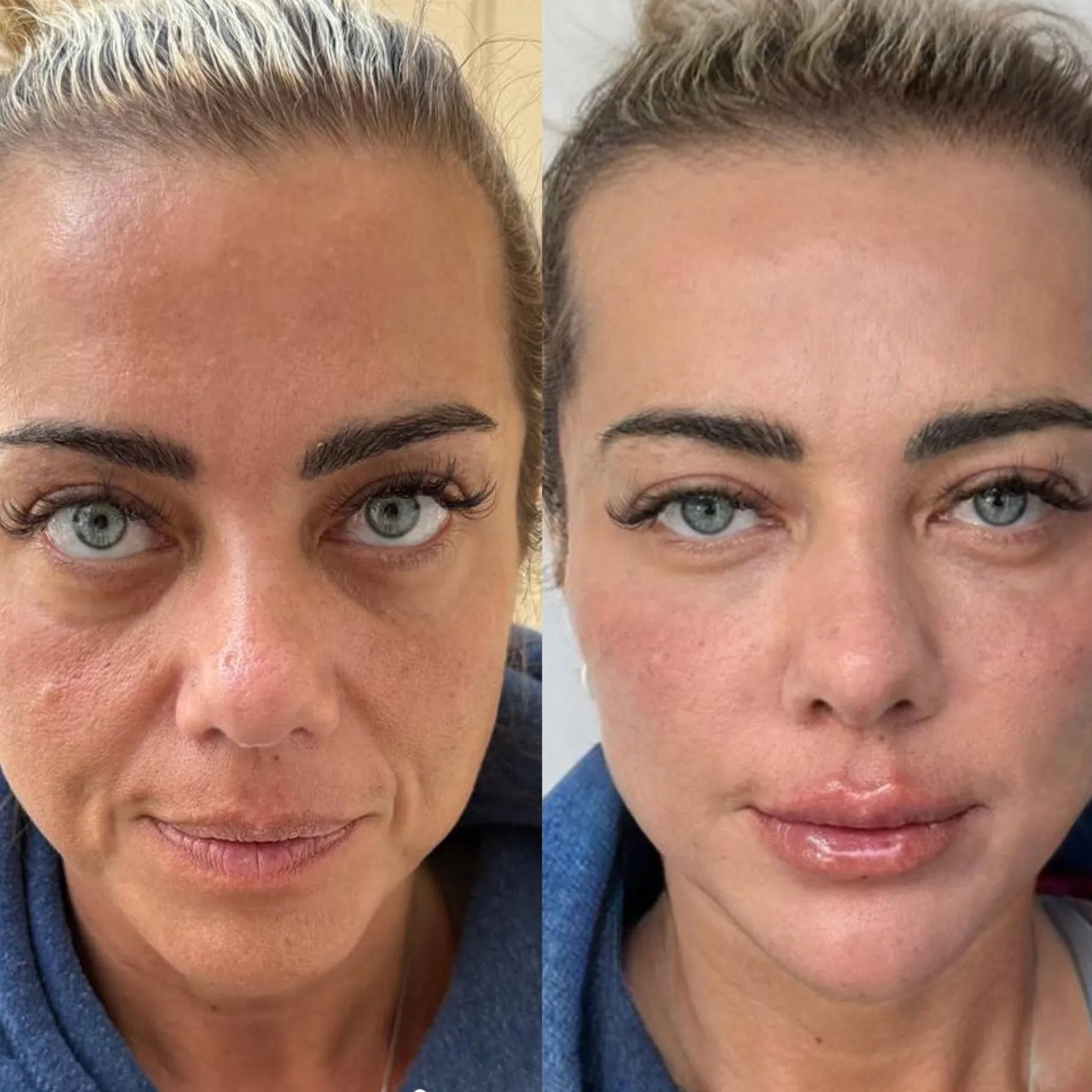 Imagem comparativa de antes e depois 4, em validação