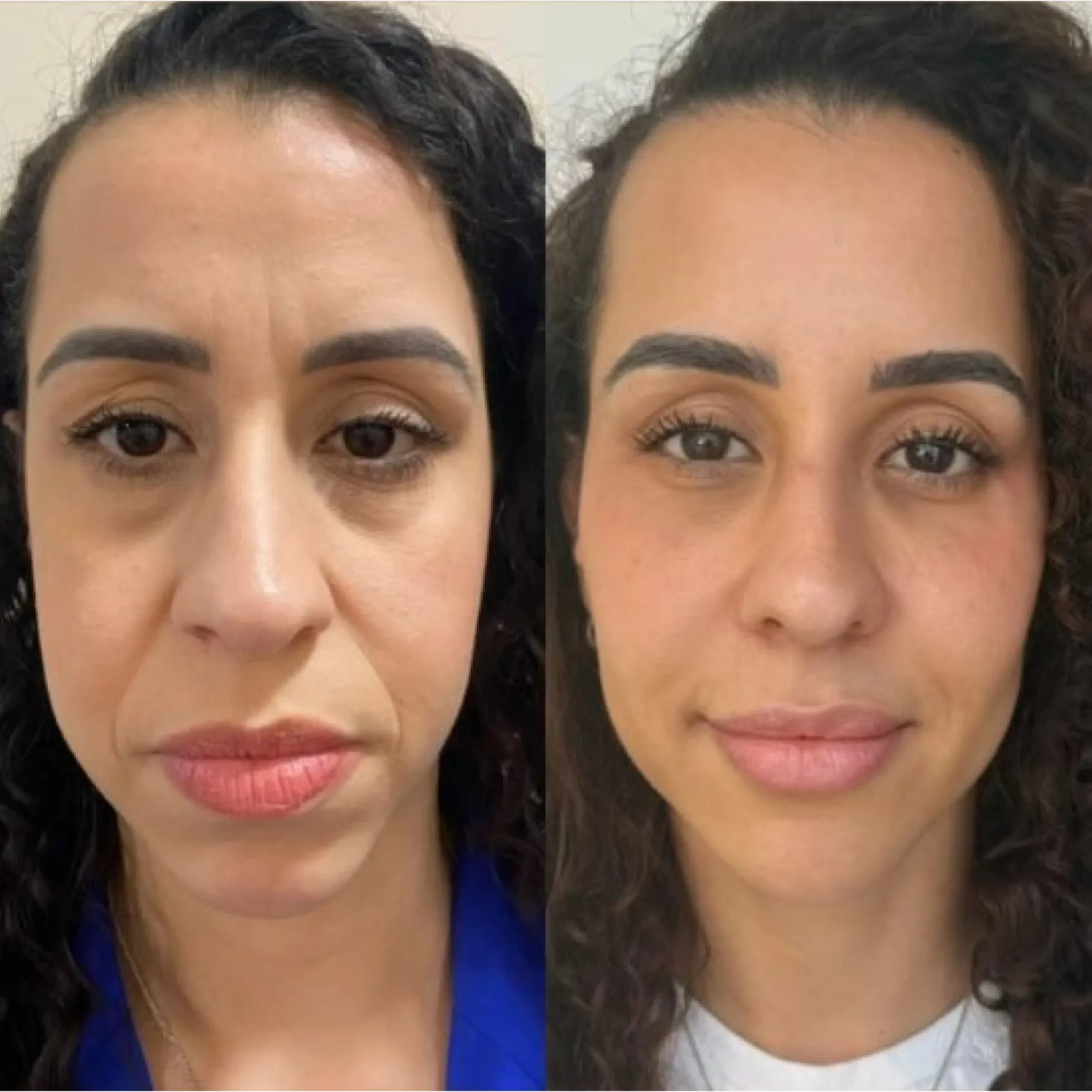 Imagem comparativa de antes e depois 7, em validação